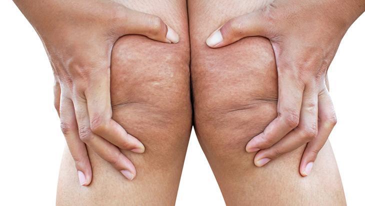 lipodem kadinlarin sessiz cigligi neden kilo veremiyorum diyenler icin cevap z3fBbgfS.jpg