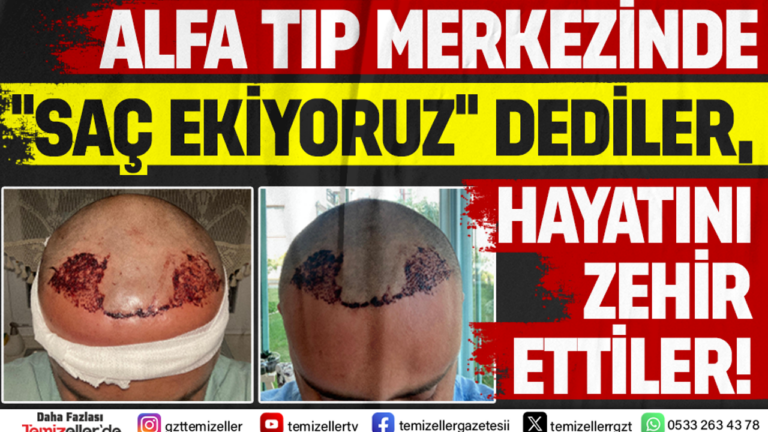 alfa-tip-merkezinde-sac-ekiyoruz-dediler-hayati-zehir-ettiler-Y6CVCURT.png